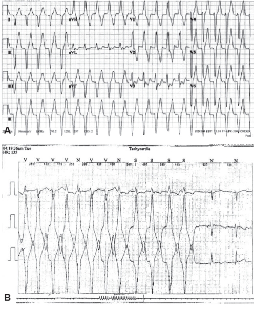 Figure 4)