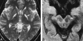 <sc>fig</sc> 5.