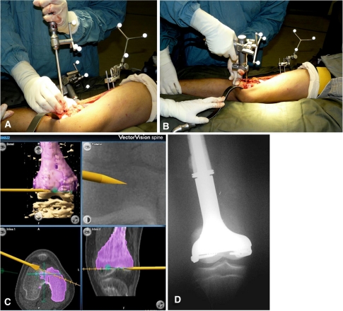 Fig. 3A–D