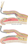 Fig. 13.
