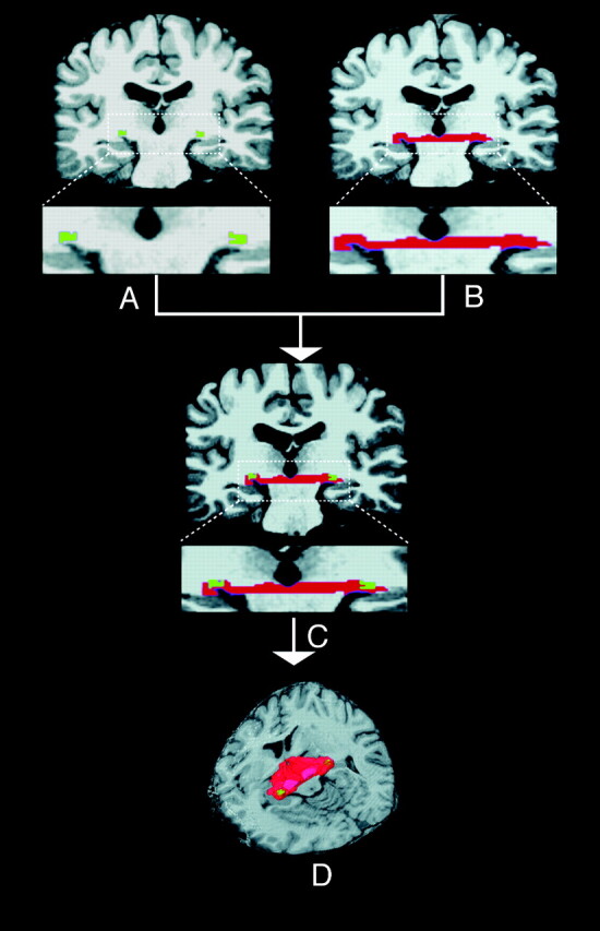 Fig 3.