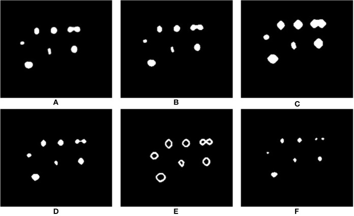 Figure 11