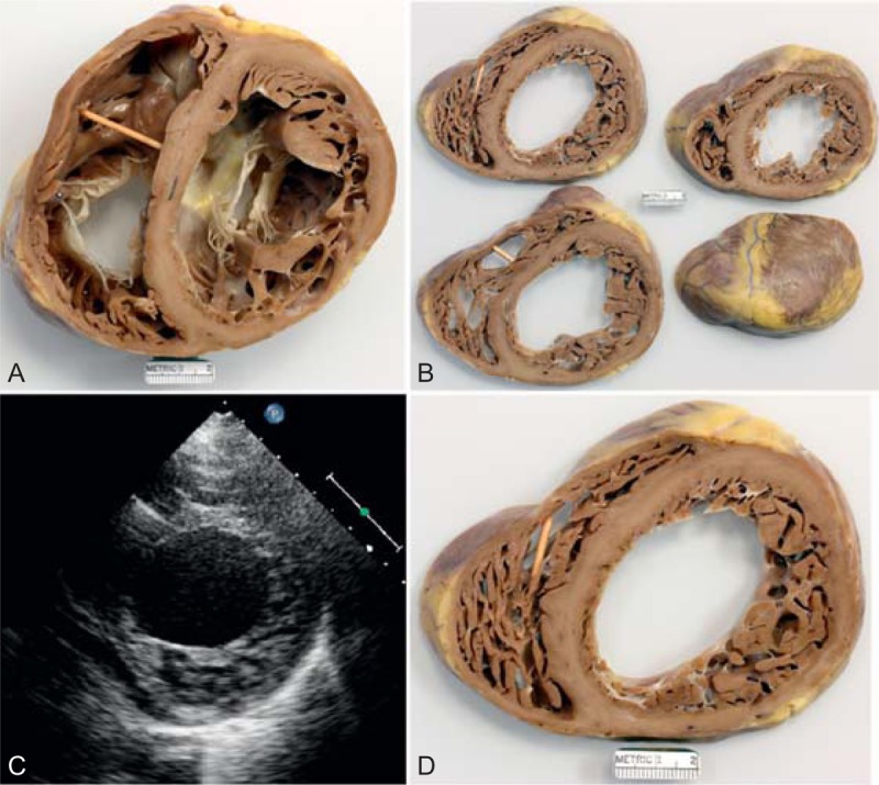 FIGURE 22