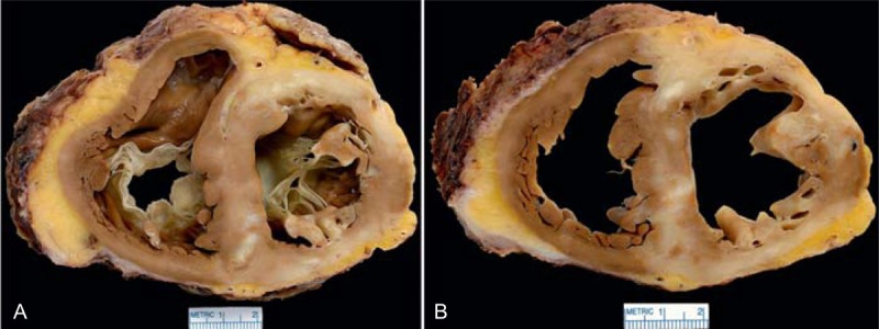 FIGURE 19