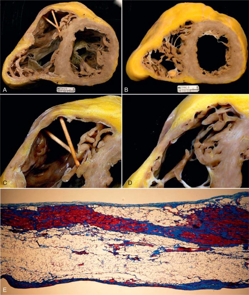 FIGURE 26