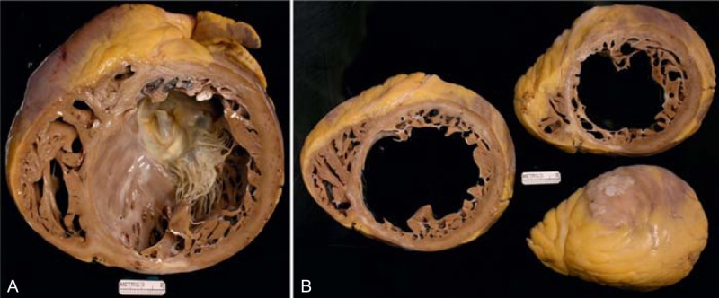 FIGURE 24