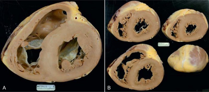 FIGURE 28