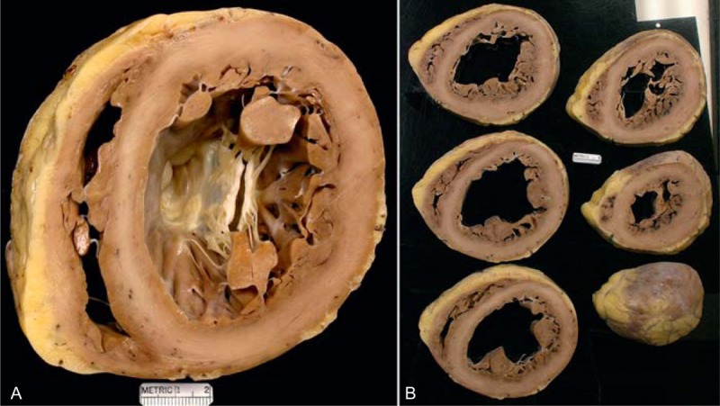 FIGURE 15