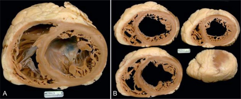 FIGURE 29