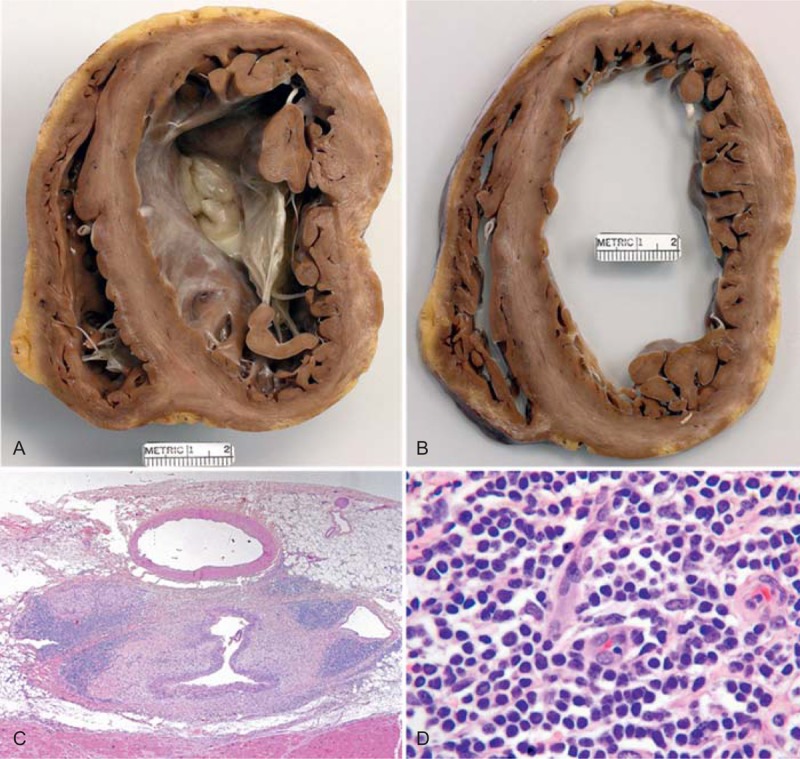 FIGURE 25