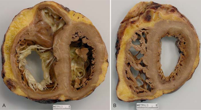 FIGURE 17