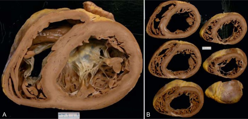 FIGURE 16