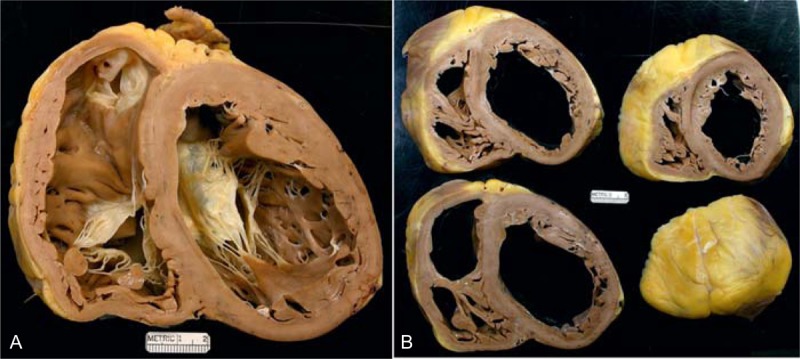 FIGURE 14