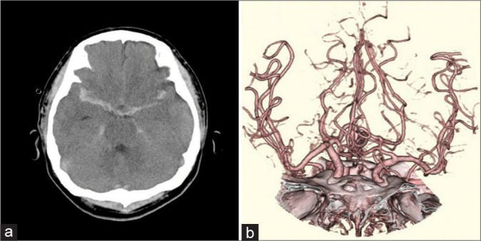 Figure 1: