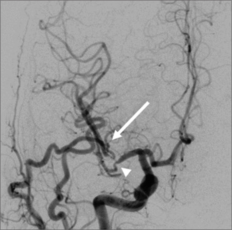 Figure 5: