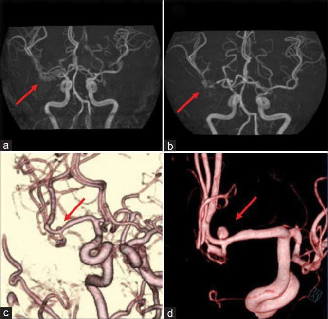 Figure 2: