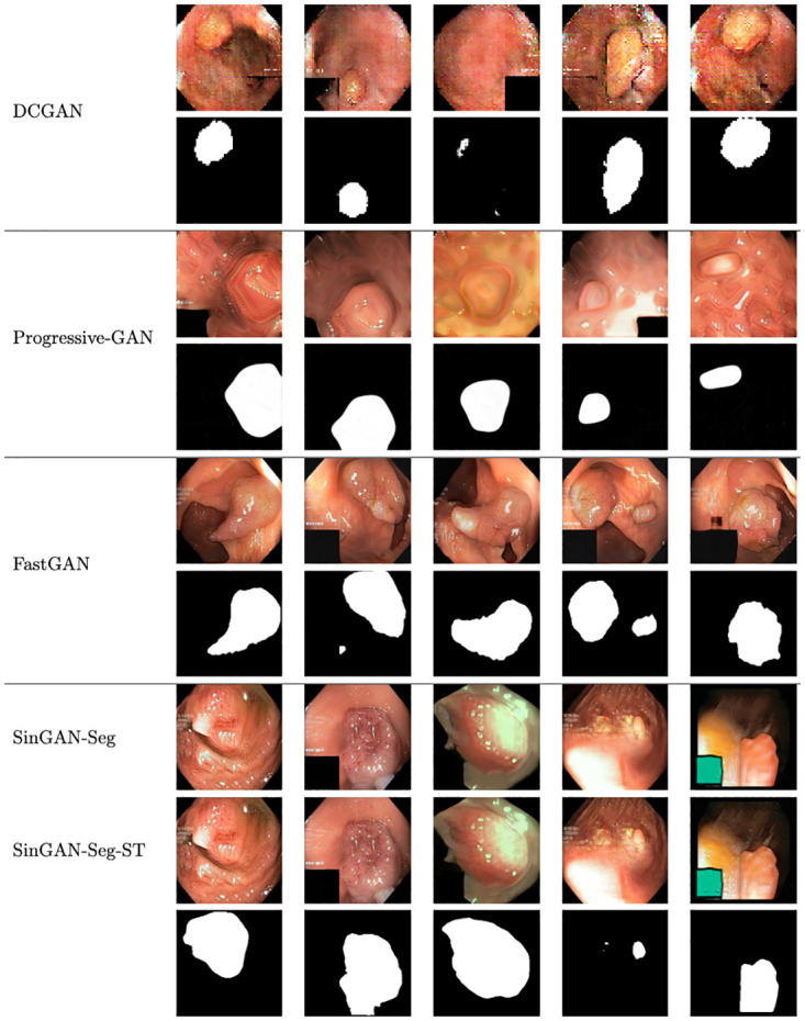 Fig 12