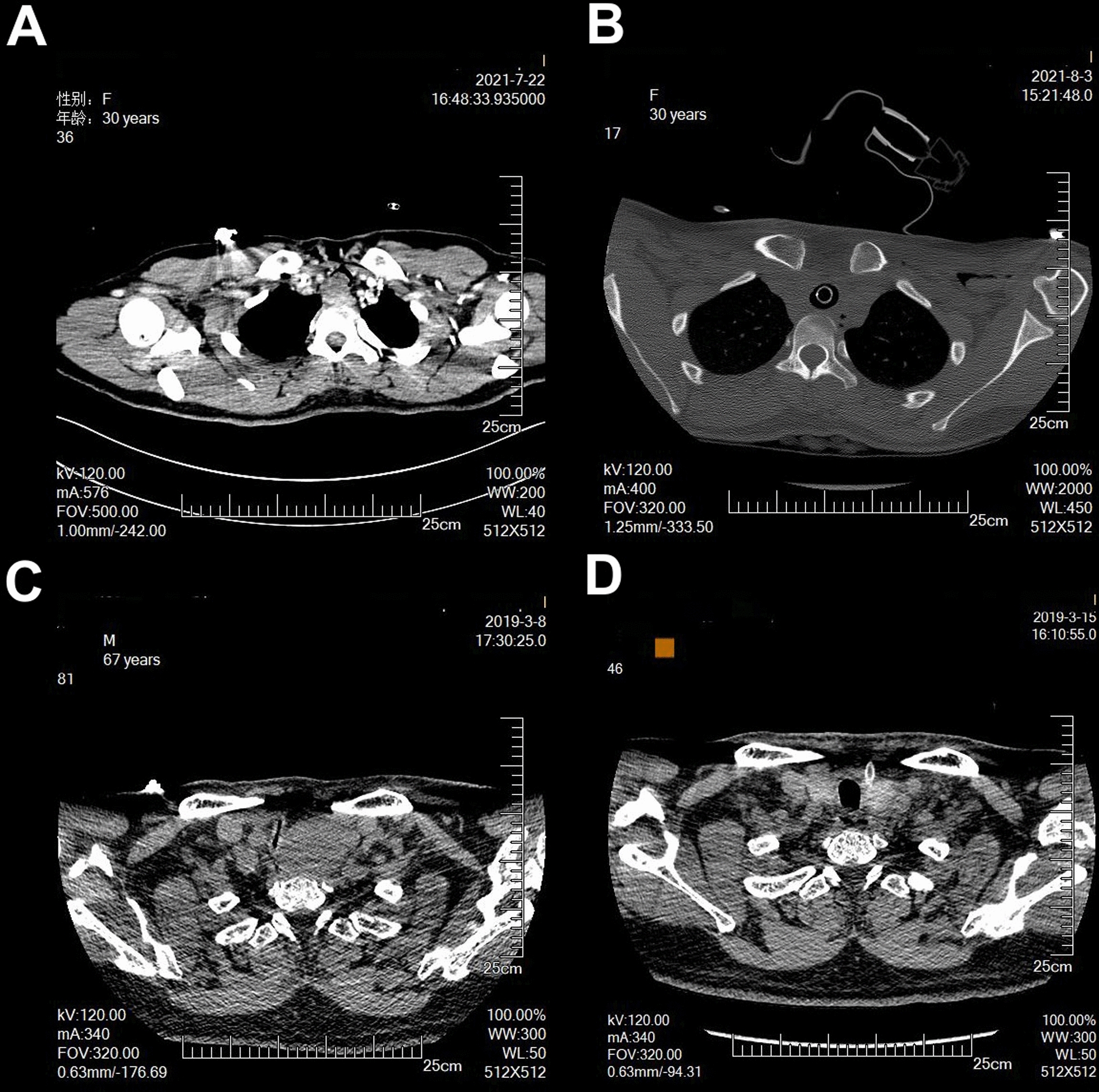 Fig. 2