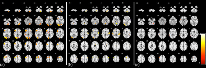 FIGURE 4