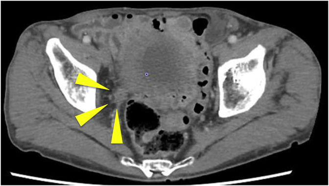 Fig. 2