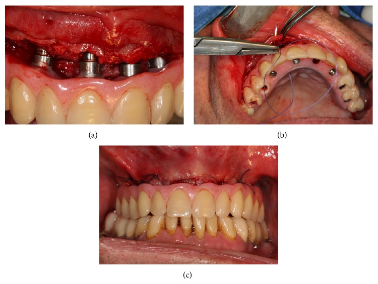 Figure 6