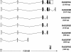 Fig. 11