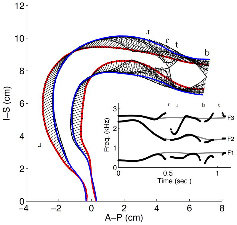 Figure 11