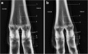 Fig. 11