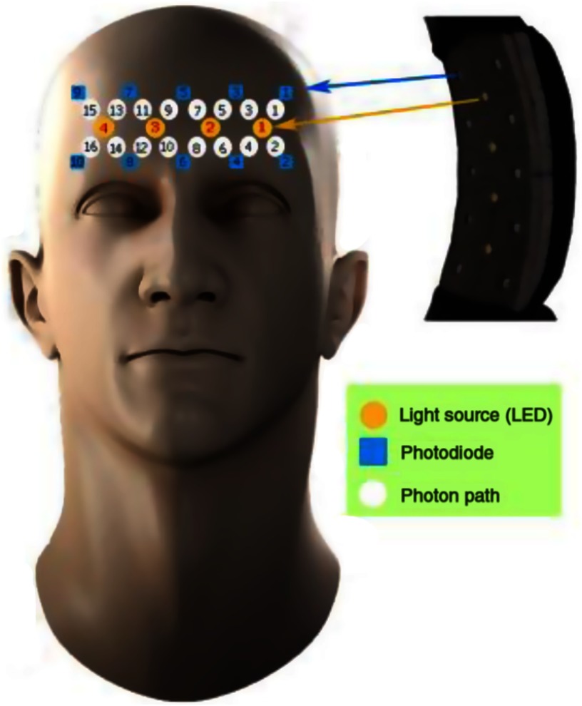 Fig. 2