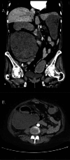 Fig 2