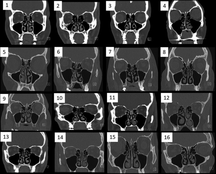 Fig 1