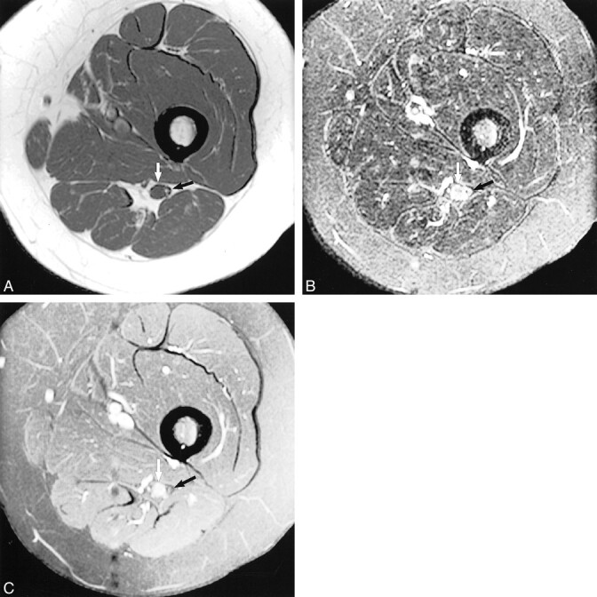 fig 5.