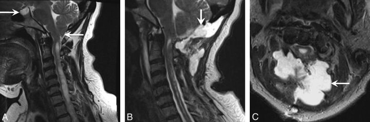 Fig 1.