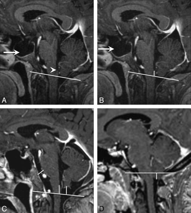 Fig 2.