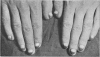265