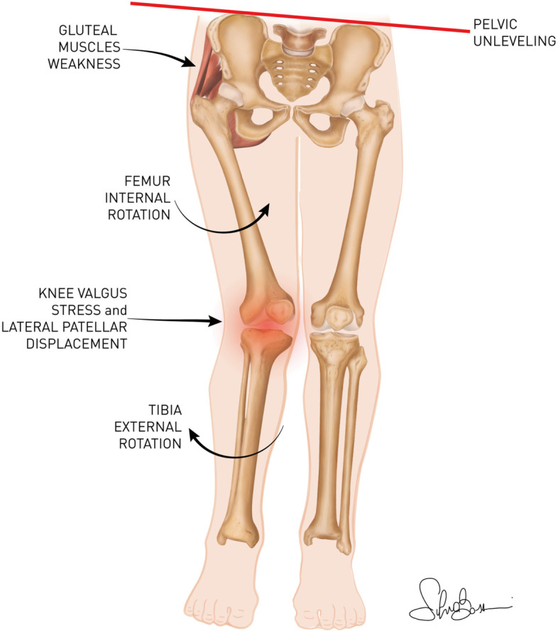 Fig. 2