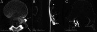 FIG 1.