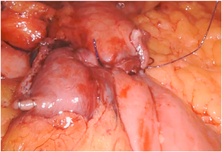 Fig. 1b