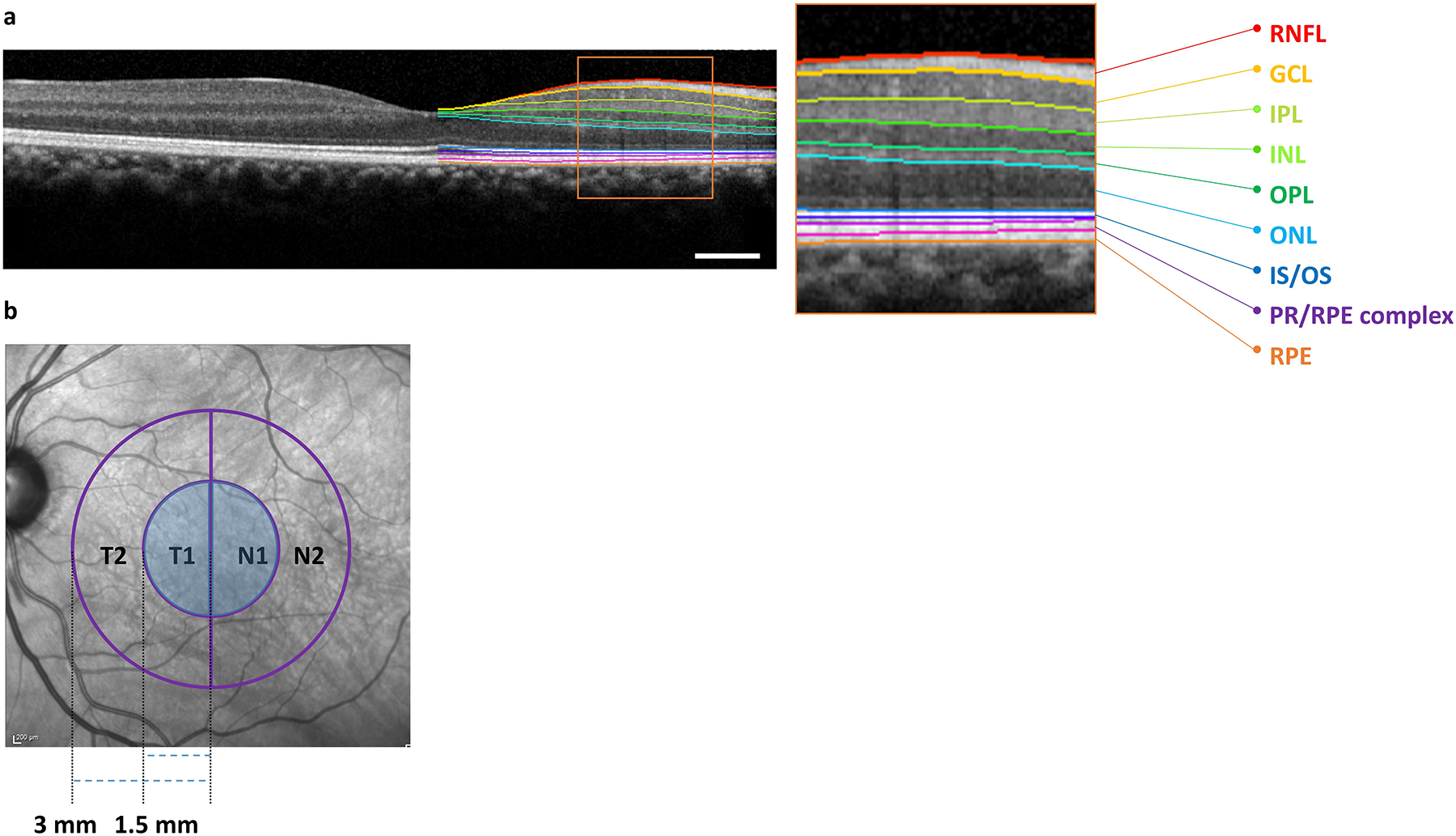 Figure 1: