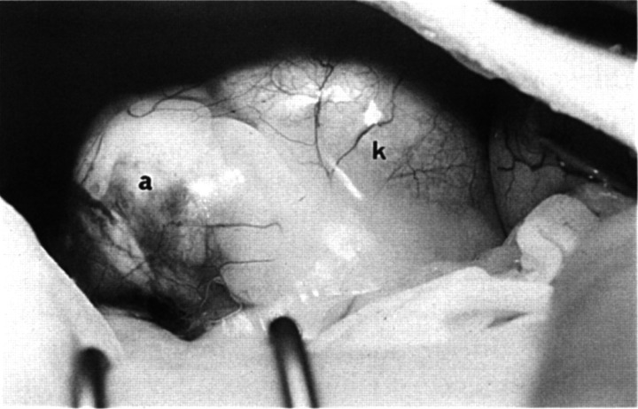 Fig 2.