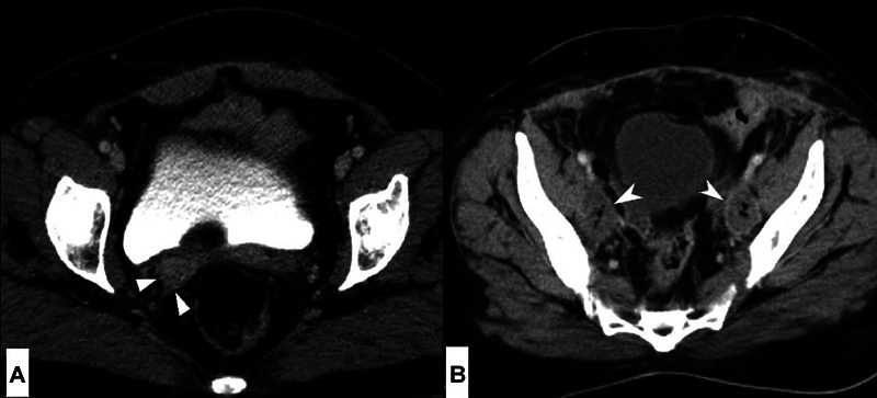 Fig. 11