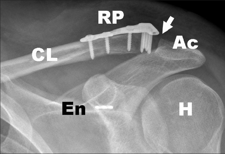 Figure 1b