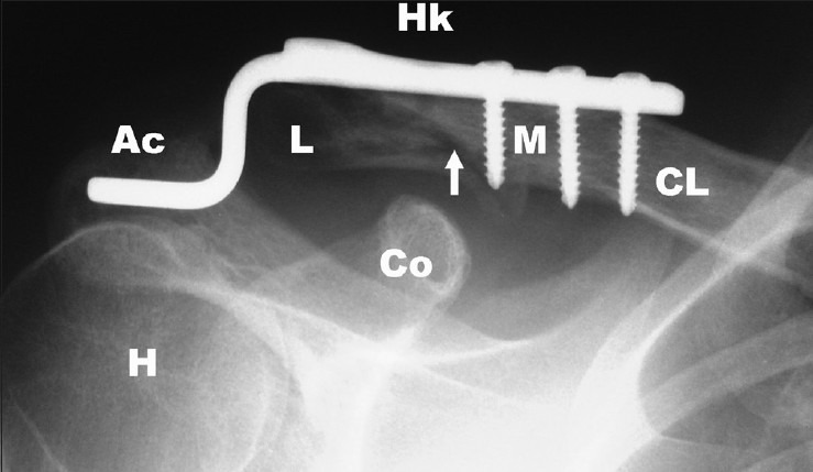 Figure 1a