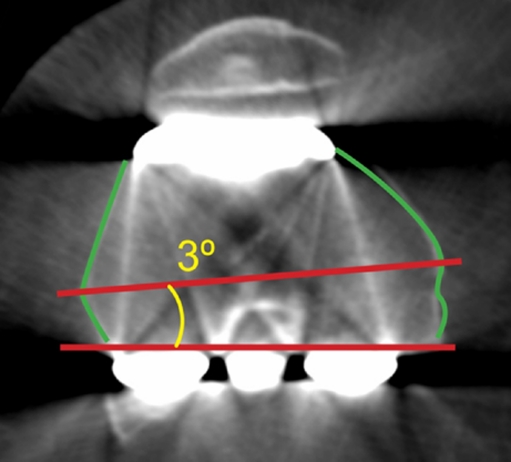 Fig. 3