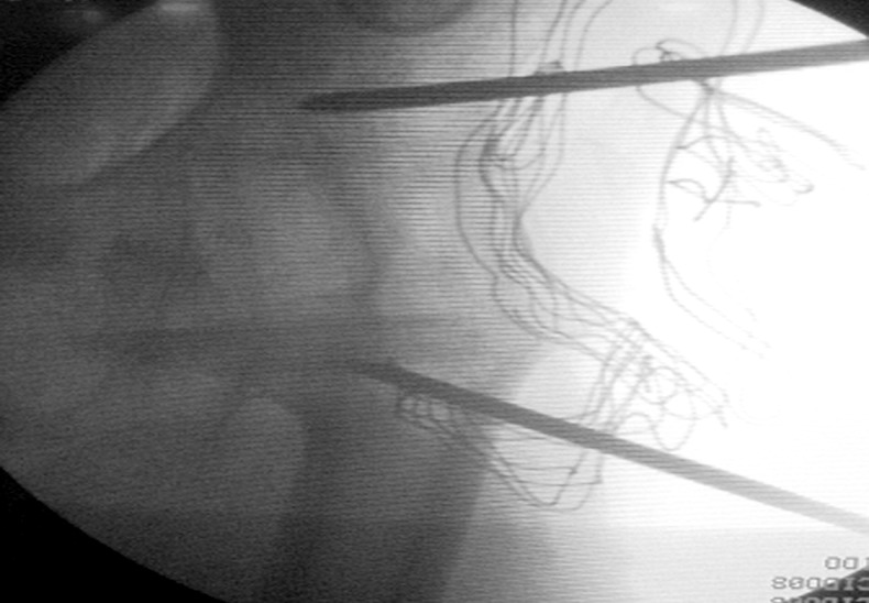 Fig. 3