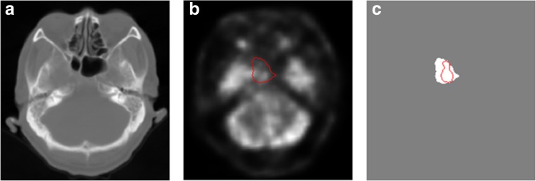 Fig. 4