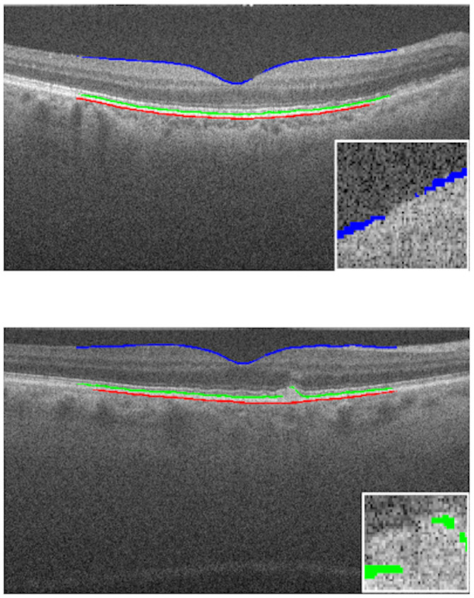 Fig 10