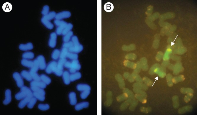 Fig. 14.