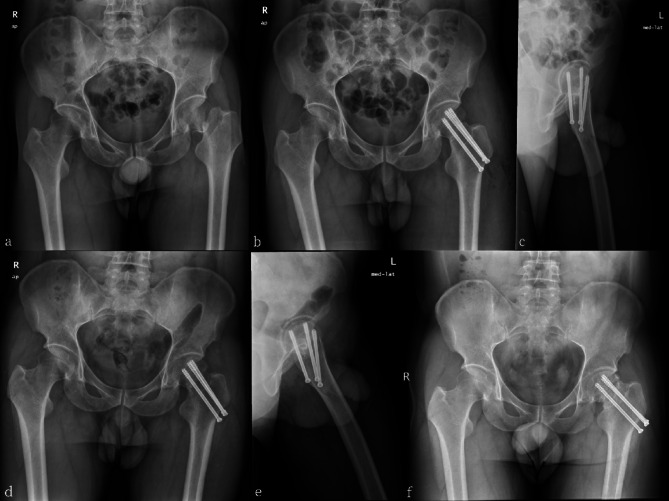 Fig. 3