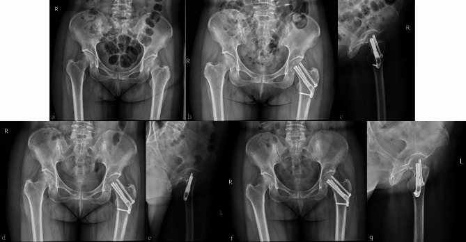Fig. 6
